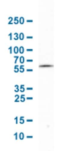 TNFRSF1B, Rabbit anti-Human, Polyclonal Antibody, Abnova 100&mu;L; Unconjugated:Antibodies,