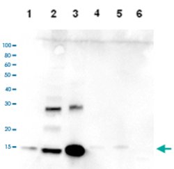 HIST3H2A, Rabbit anti-Human, Polyclonal Antibody, Abnova 50&mu;g; Unconjugated:Antibodies,