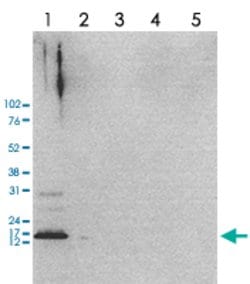 H2AFZ, Rabbit anti-Human, Polyclonal Antibody, Abnova 50&mu;g; Unconjugated:Antibodies,