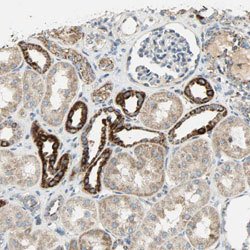 NNT, Rabbit anti-Human, Polyclonal Antibody, Abnova 100&mu;L; Unconjugated:Antibodies,