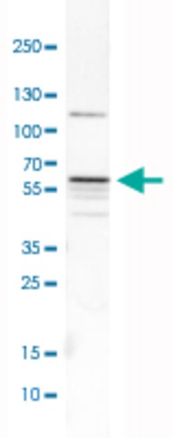 MATK, Rabbit anti-Human, Polyclonal Antibody, Abnova 100&mu;L; Unconjugated:Antibodies,