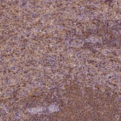MATK, Rabbit anti-Human, Polyclonal Antibody, Abnova 100&mu;L; Unconjugated:Antibodies,