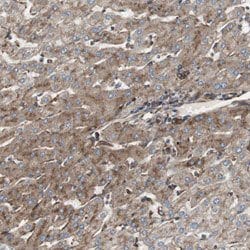 H6PD, Rabbit anti-Human, Polyclonal Antibody, Abnova 100 &mu;L | Buy Online | Abnova | Fisher Scientific