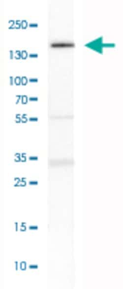 TULP4, Rabbit anti-Human, Polyclonal Antibody, Abnova 100&mu;L; Unconjugated:Antibodies,