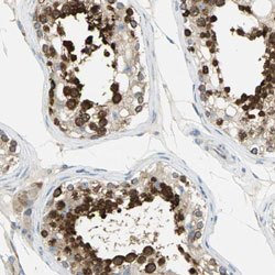 TULP4, Rabbit anti-Human, Polyclonal Antibody, Abnova 100&mu;L; Unconjugated:Antibodies,