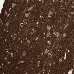 SNCA, Rabbit anti-Human, Polyclonal Antibody, Abnova 100&mu;L; Unconjugated:Antibodies,