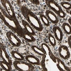 KANK1, Rabbit anti-Human, Polyclonal Antibody, Abnova 100&mu;L; Unconjugated:Antibodies,
