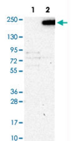 KANK1, Rabbit anti-Human, Polyclonal Antibody, Abnova 100&mu;L; Unconjugated:Antibodies,