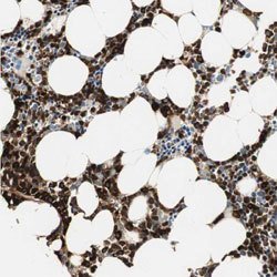 PRTN3, Rabbit anti-Human, Polyclonal Antibody, Abnova 100&mu;L; Unconjugated:Antibodies,