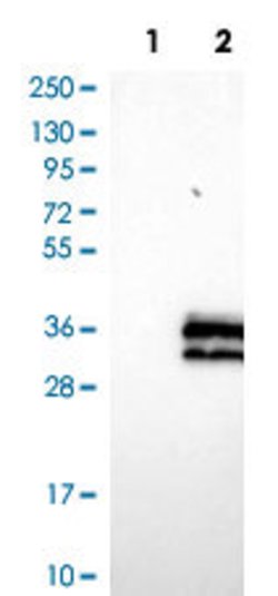 PRTN3, Rabbit anti-Human, Polyclonal Antibody, Abnova 100&mu;L; Unconjugated:Antibodies,