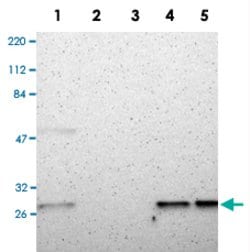 CSNK2B, Rabbit anti-Human, Polyclonal Antibody, Abnova 100&mu;L; Unconjugated:Antibodies,