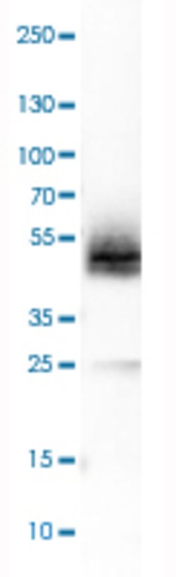 PDPN, Rabbit anti-Human, Polyclonal Antibody, Abnova 100&mu;L; Unconjugated:Antibodies,