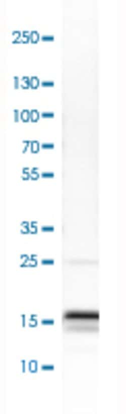 MAP1LC3A, Rabbit anti-Human, Polyclonal Antibody, Abnova 100&mu;L; Unconjugated:Antibodies,