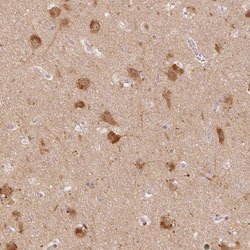 MAP1LC3A, Rabbit anti-Human, Polyclonal Antibody, Abnova 100&mu;L; Unconjugated:Antibodies,