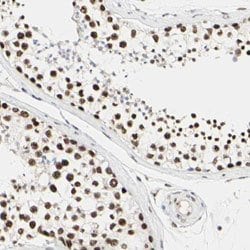 PRMT3, Rabbit anti-Human, Polyclonal Antibody, Abnova 100&mu;L; Unconjugated:Antibodies,