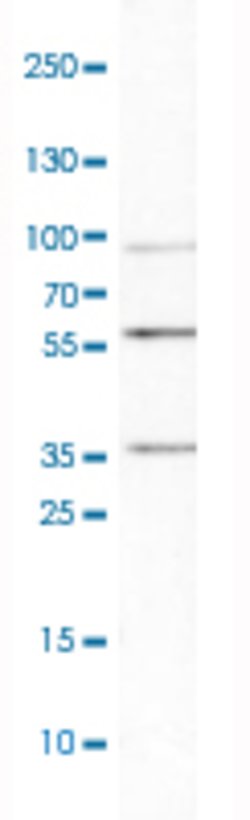 MMP3, Rabbit anti-Human, Polyclonal Antibody, Abnova 100&mu;L; Unconjugated:Antibodies,