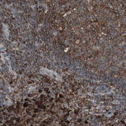 MMP3, Rabbit anti-Human, Polyclonal Antibody, Abnova 100&mu;L; Unconjugated:Antibodies,