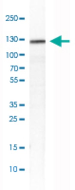 MCAM, Rabbit anti-Human, Polyclonal Antibody, Abnova 100&mu;L; Unconjugated:Antibodies,