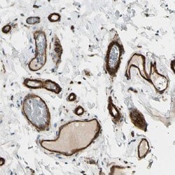 MCAM, Rabbit anti-Human, Polyclonal Antibody, Abnova 100&mu;L; Unconjugated:Antibodies,