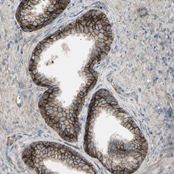 CD276, Rabbit anti-Human, Polyclonal Antibody, Abnova 100&mu;L; Unconjugated:Antibodies,
