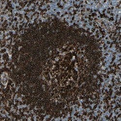 CD74, Rabbit anti-Human, Polyclonal Antibody, Abnova 100&mu;L; Unconjugated:Antibodies,