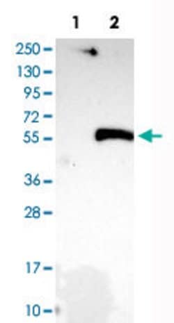 SIRT2, Rabbit anti-Human, Polyclonal Antibody, Abnova 100&mu;L; Unconjugated:Antibodies,