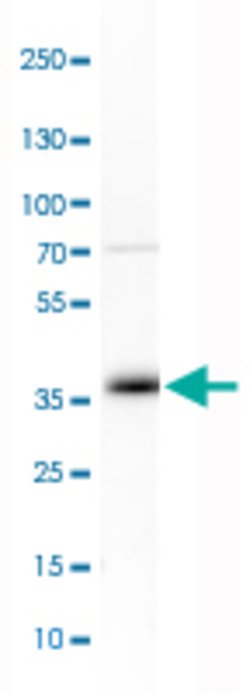GDF15, Rabbit anti-Human, Polyclonal Antibody, Abnova 100&mu;L; Unconjugated:Antibodies,