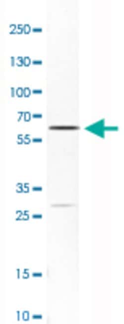 CES1, Rabbit anti-Human, Polyclonal Antibody, Abnova 100&mu;L; Unconjugated:Antibodies,