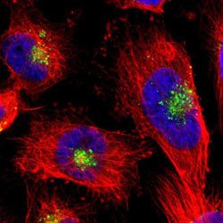 CST3, Rabbit anti-Human, Polyclonal Antibody, Abnova&trade;