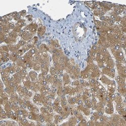 CYP4F2, Rabbit anti-Human, Polyclonal Antibody, Abnova 100&mu;L; Unconjugated:Antibodies,