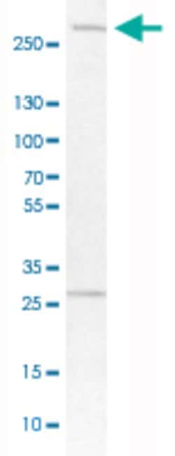LRRK2, Rabbit anti-Human, Polyclonal Antibody, Abnova 100&mu;L; Unconjugated:Antibodies,