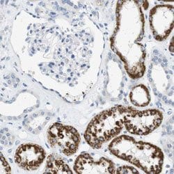 LRRK2, Rabbit anti-Human, Polyclonal Antibody, Abnova 100&mu;L; Unconjugated:Antibodies,