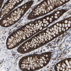 MARCH8, Rabbit anti-Human, Polyclonal Antibody, Abnova 100&mu;L; Unconjugated:Antibodies,