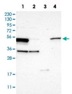 ALDH3A2, Rabbit anti-Human, Polyclonal Antibody, Abnova 100 &mu;L | Buy Online | Abnova | Fisher Scientific