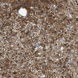 ALDH3A2, Rabbit anti-Human, Polyclonal Antibody, Abnova 100 &mu;L | Buy Online | Abnova | Fisher Scientific