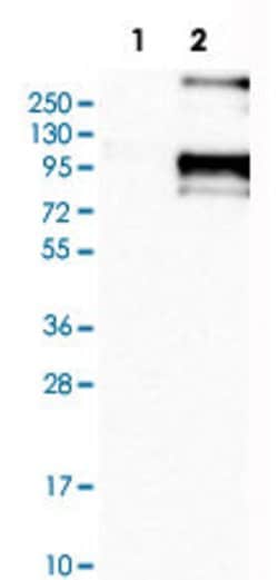 SCNN1B, Rabbit anti-Human, Polyclonal Antibody, Abnova 100&mu;L; Unconjugated:Antibodies,