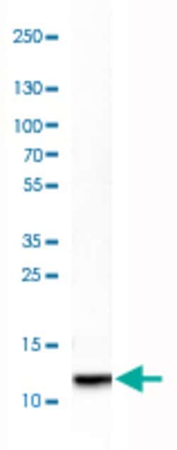 DEFA5, Rabbit anti-Human, Polyclonal Antibody, Abnova 100&mu;L; Unconjugated:Anticuerpos