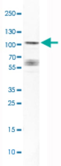 DYRK1A, Rabbit anti-Human, Polyclonal Antibody, Abnova 100&mu;L; Unconjugated:Antibodies,