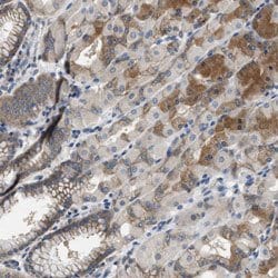 COPS2, Rabbit anti-Human, Polyclonal Antibody, Abnova 100&mu;L; Unconjugated:Antibodies,