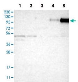 ITGB2, Rabbit anti-Human, Polyclonal Antibody, Abnova 100&mu;L; Unconjugated:Antibodies,