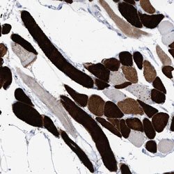PDE6A, Rabbit anti-Human, Polyclonal Antibody, Abnova 100 &mu;L | Buy Online | Abnova | Fisher Scientific