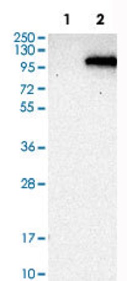PDE6A, Rabbit anti-Human, Polyclonal Antibody, Abnova 100 &mu;L | Buy Online | Abnova | Fisher Scientific