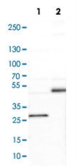 DLC1, Rabbit anti-Human, Polyclonal Antibody, Abnova 100&mu;L; Unconjugated:Antibodies,