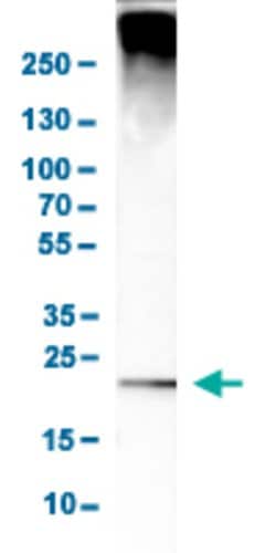DERL1, Rabbit anti-Human, Polyclonal Antibody, Abnova 100&mu;L; Unconjugated:Antibodies,