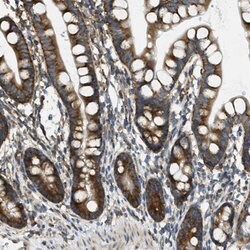ABCF1, Rabbit anti-Human, Polyclonal Antibody, Abnova 100&mu;L; Unconjugated:Antibodies,