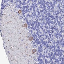 KCNK18, Rabbit anti-Human, Polyclonal Antibody, Abnova 100&mu;L; Unconjugated:Antibodies,
