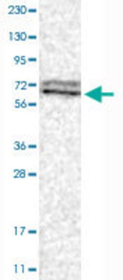 RPA1, Rabbit anti-Human, Polyclonal Antibody, Abnova 100&mu;L; Unconjugated:Antibodies,