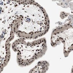RPA1, Rabbit anti-Human, Polyclonal Antibody, Abnova 100&mu;L; Unconjugated:Antibodies,