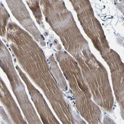 PANK4, Rabbit anti-Human, Polyclonal Antibody, Abnova 100&mu;L; Unconjugated:Antibodies,