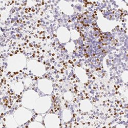 PADI4, Rabbit anti-Human, Polyclonal Antibody, Abnova 100&mu;L; Unconjugated:Antibodies,